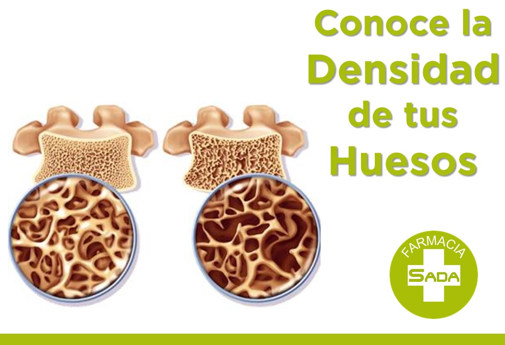 Mide la densidad de tus huesos