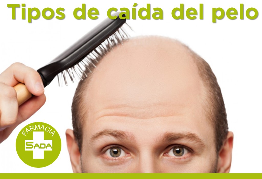 ¿Cómo distinguir el tipo de caída del pelo?