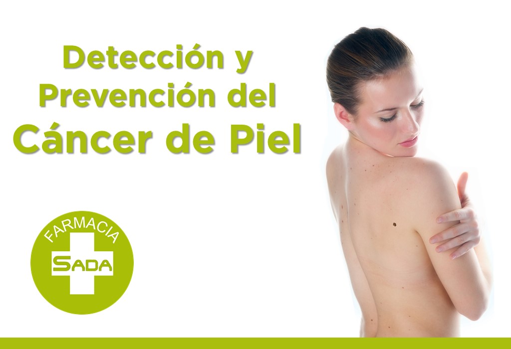 Detección y Prevención del Cáncer de Piel