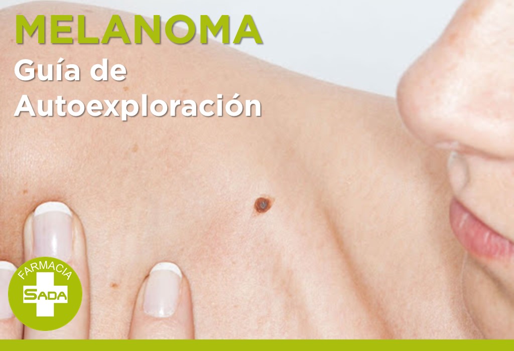 MELANOMA – Guía de Autoexploración
