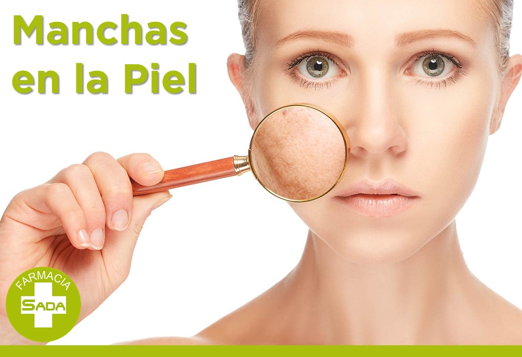 Manchas en la Piel