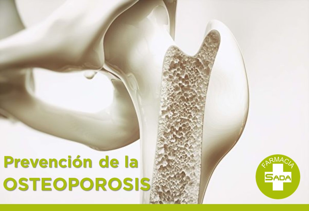 Prevención de la OSTEOPOROSIS