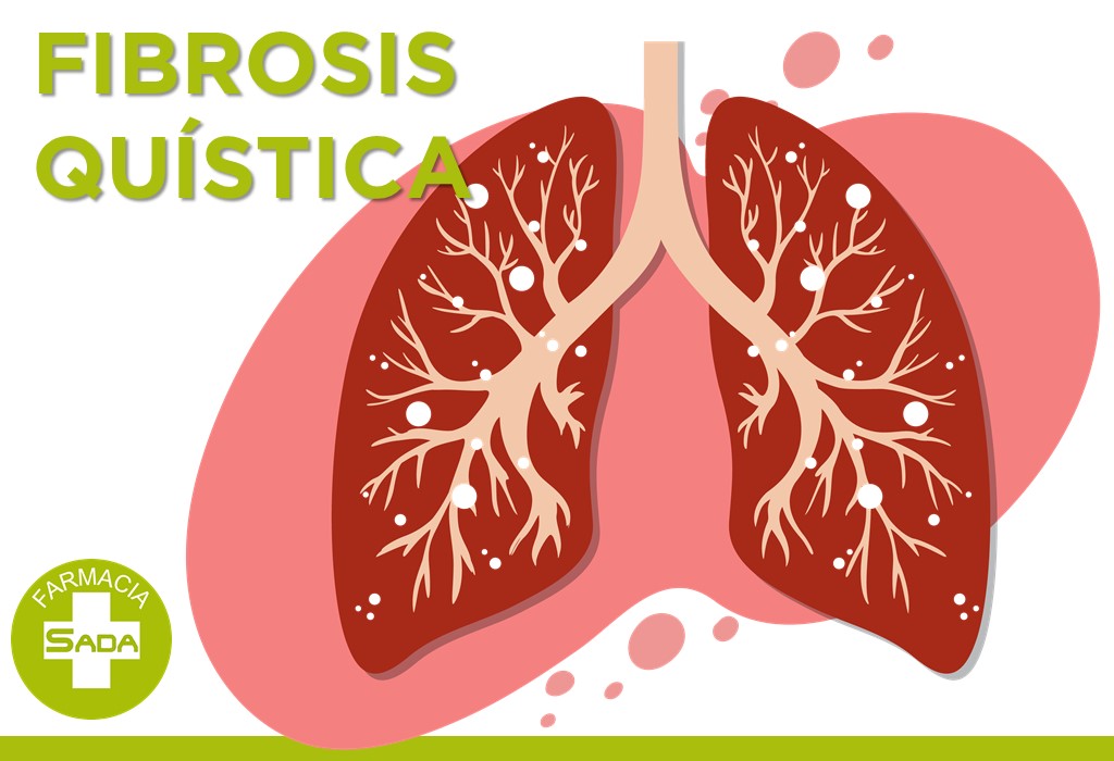 Fibrosis Quística