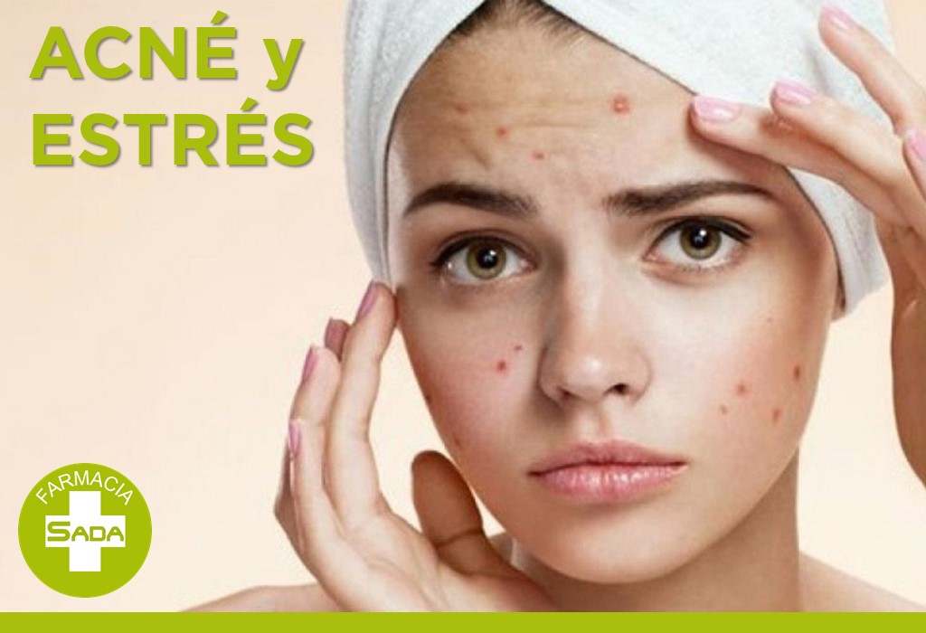 Estrés y Acné: Cómo Afrontarlos Juntos