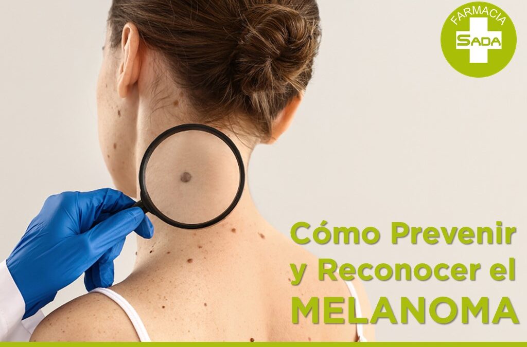 Cómo Prevenir y Reconocer el Melanoma