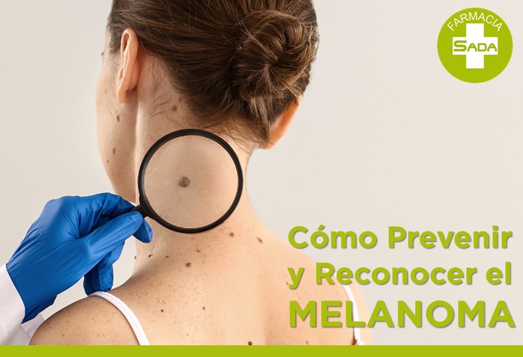 Cómo Prevenir y Reconocer el Melanoma