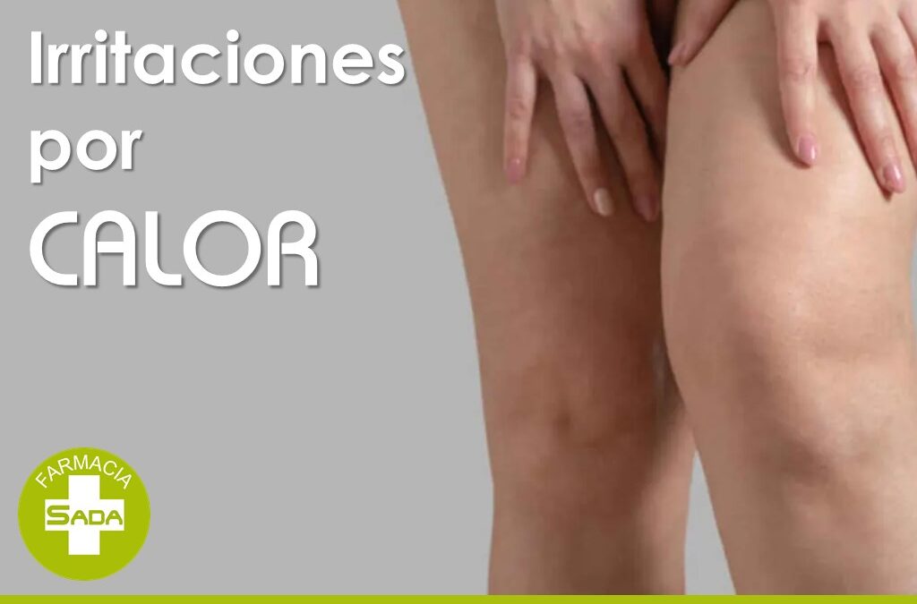 Rozaduras, irritaciones y sudor: cómo cuidar la piel cuando aprieta el calor