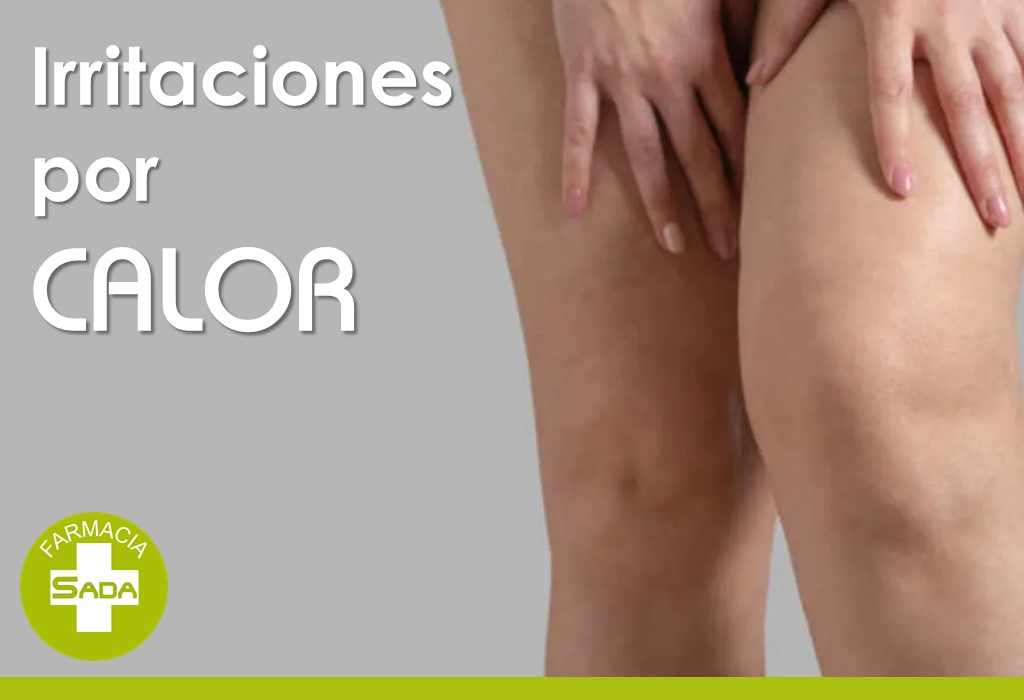 Rozaduras, irritaciones y sudor: cómo cuidar la piel cuando aprieta el calor